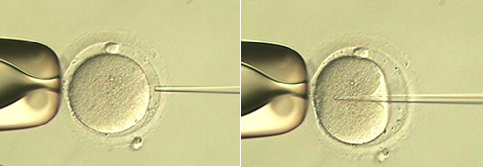 Piezo-ICSI