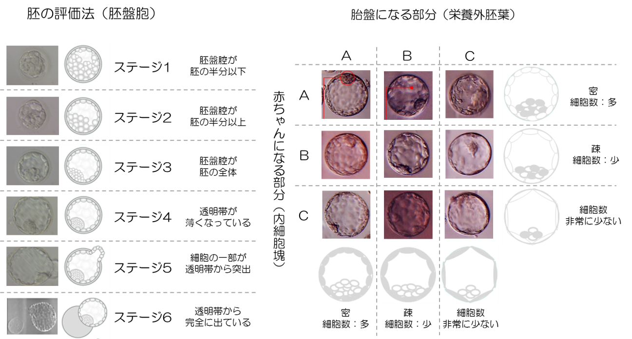 胚の評価（Day5：胚盤胞）